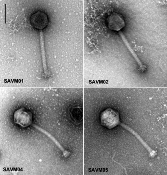 Morphologies of SAVM01, SAVM02; SAVM04, SAVM05 staphylococcal phages observed using TEM.